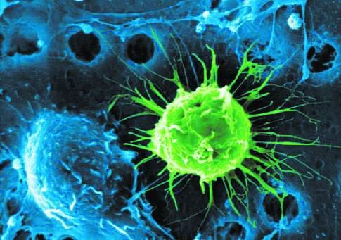 天津医科大学发现肿瘤招募干细胞促进肿瘤生长和进展的新机制