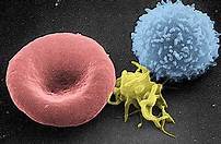 Science：白<font color="red">细胞</font>介素-22结合蛋白参与炎症性肠病的发生发展