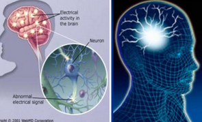 Epilepsia：新型认知行为治疗方法可改善癫痫患者情绪