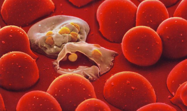 Nature：科学家筛选出一类新的抗疟疾药物二环吖丁啶