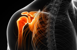 ASES 2016：反向肩关节置换术，负重或不负重患者的效果类似