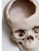 可被<font color="red">人体</font>吸收的3D打印聚合物颅骨植入物