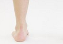 Eur J Clin Nutr：小腿围可用来筛查非瘫痪卒中患者的营养状况