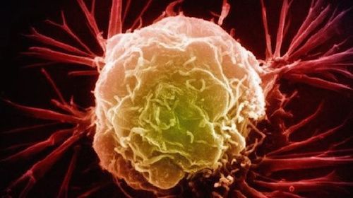 Nature：科学家们发现了一种新的癌症克星”S63845”