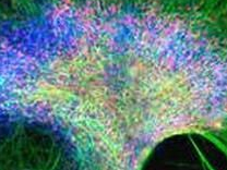 PNAS：血管在神经干细胞增殖中发挥关键作用