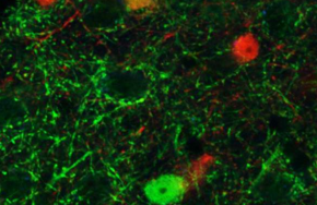 Nature子刊：GABA能神经元或成为抗抑郁药的新靶点