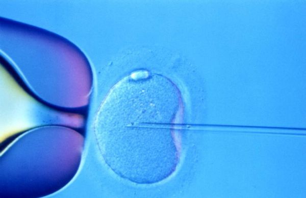 Cell Stem Cell：新技术或可加倍不孕不育症疗法的成功率