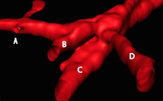 SCI REP：巨噬<font color="red">细胞</font>“不务正业” 形成血管促进肿瘤<font color="red">生长</font>