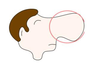 JAAD：酒渣鼻患者的偏头痛风险研究