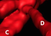 Nature子刊：巨噬细胞“不务正业” <font color="red">形成</font>血管促进<font color="red">肿瘤</font>生长