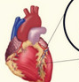 【盘点】近期缺血性心脏病重要研究汇总