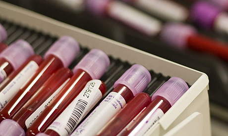 是什么又让血液检测登上Nature Medicine？