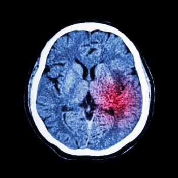 Brain Behav Immun：振奋人心！老药新用，抗炎药可有效对抗脑卒中，促进脑细胞再生