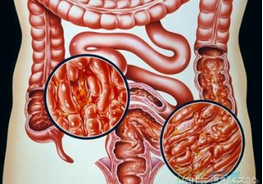 2016 ENETS共识指南：胃<font color="red">十二指肠</font>神经内分泌肿瘤（更新版）