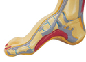 急性踝关节<font color="red">三角</font>韧带损伤的诊疗进展