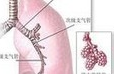【盘点】近期非小细胞肺癌指南共识汇总（二）