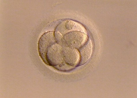 Gene Dev：卵细胞受精后发生了<font color="red">什么</font>？