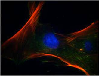 Exp Biol Med：人间充<font color="red">质</font>干细胞在体外培养时存在自发性的肿瘤转化