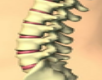 退变性脊柱侧凸近端融合椎的选择：原则及相关问题