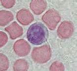 2017 NCCN临床实践指南：T<font color="red">细胞</font>淋巴<font color="red">瘤</font>（2017.V1）