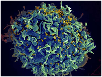 两篇JCI证实靶向干扰素或可提高抗逆转录病毒药物治疗HIV的疗效