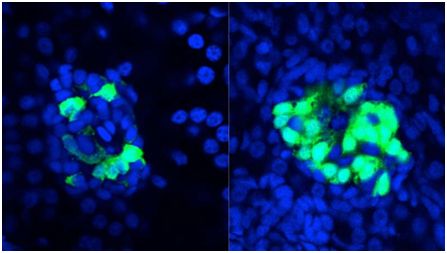 肠道<font color="red">细菌</font>蛋白BefA促进β细胞增殖