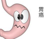 临床上常见的胃癌 7 大病因
