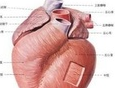 “高敏感”心肌标志物早诊早治急性心梗