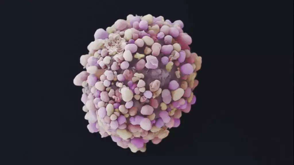 癌细胞真实图片显微镜图片