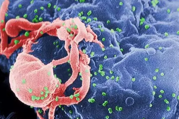 艾滋病，你站住！CRISPR/Cas9给你点颜色看看