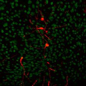Cell Reports：干细胞转变为神经元的新方法