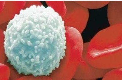 自体细胞改造“杀灭”癌细胞