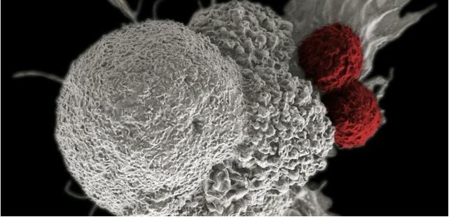 一种全新对付癌细胞的方法明年将进入临床
