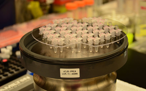 Sci Transl Med：新的血液检测可以测到朊病毒