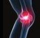 专家述评--重新认识膝骨性<font color="red">关节</font>炎的诊断和防治