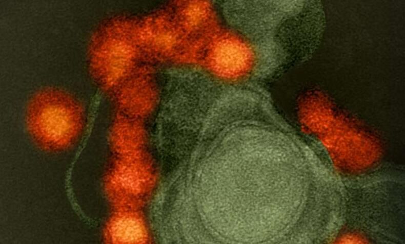 科学家首次鉴别出让寨卡病毒如此<font color="red">致命</font>的关键蛋白