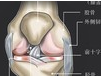 医用臭氧治疗膝骨性关节炎安全性的研究进展
