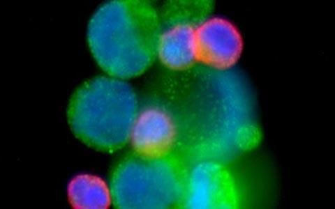 Science：SOX2促进前列腺癌产生治疗抵抗性机制
