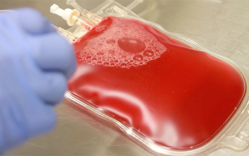 Blood：脐带血“治癌”获突破，“氧气”是功臣！