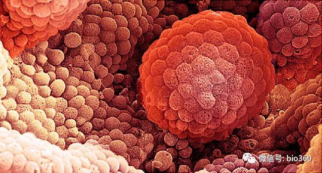 Nature：科学家发现<font color="red">前列腺癌</font>扩散的遗传指纹