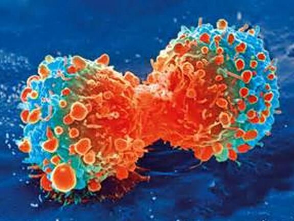 两篇重磅级文章阐明癌细胞应对遗传错误的分子机制