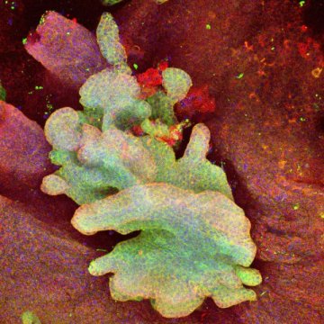2016年肿瘤干细胞重磅研究进展