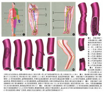 四肢及躯干主要动脉损伤诊治指南