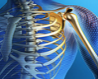 内侧支撑辅助固定肱骨近端骨折的策略