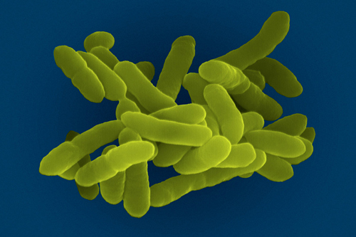 科学家警惕可抵抗所有抗生素的<font color="red">细菌</font>感染