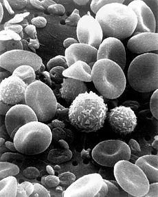 PNAS：利用循环肿瘤细胞提高对<font color="red">肝癌</font>的诊断和监测