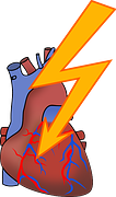 Heart：对生物可吸收血管<font color="red">支架</font>和药物洗脱<font color="red">支架</font><font color="red">治疗</font>冠状动脉疾病的二年预后比较