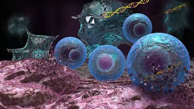 Sci Transl Med：4天将皮肤细胞变成专杀脑癌细胞的「干细胞杀手」
