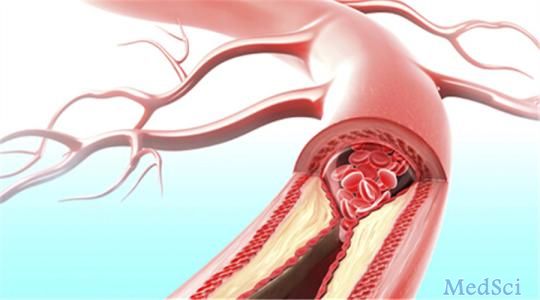 Heart：药物洗脱支架与裸金属支架在急性心肌梗死伴心源性休克的治疗中哪个更好？