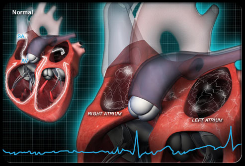 Circ-Heart Fail：主动脉波形分析有助于心衰<font color="red">个体</font>化治疗